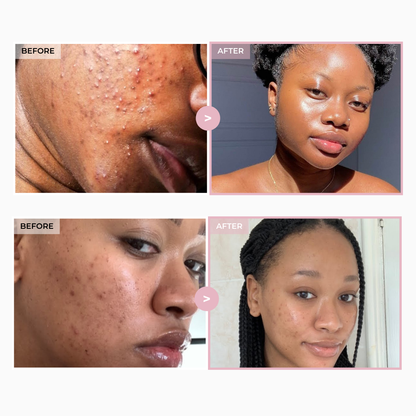 Korean Brightening Cream