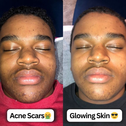 Turmeric & Kojic Acid Pads